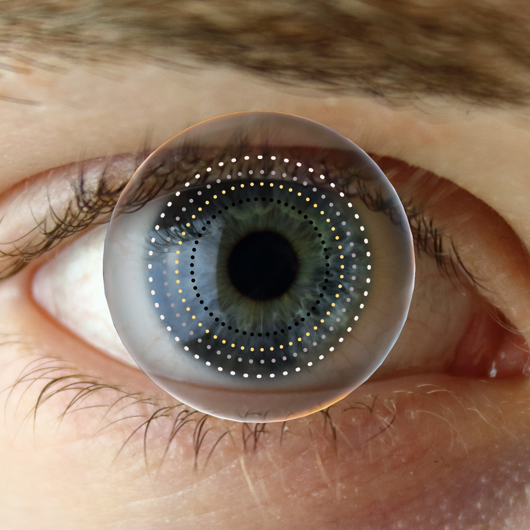 Picture of an eye with a few circles around it